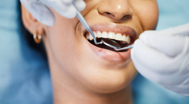 Best Emergency Tooth Extraction in Sparta, MI